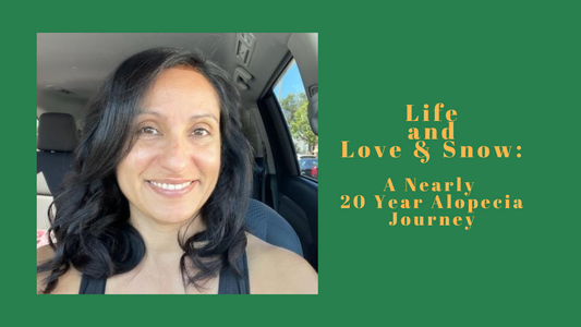Life and Love & Snow - Alison's Story:  A Nearly 20 Year Alopecia Journey