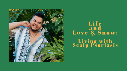 Life and Love & Snow - Gio's Story: Living w/ Scalp Psoriasis